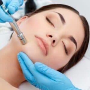 Peeling de Diamante Peeling de Diamante